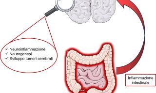 asse intestino cervello