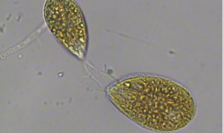 Foto 1 Cellule di Ostreopsis ovata fotografate al microscopio mentre “nuotano”. Foto di Abbate Marinella